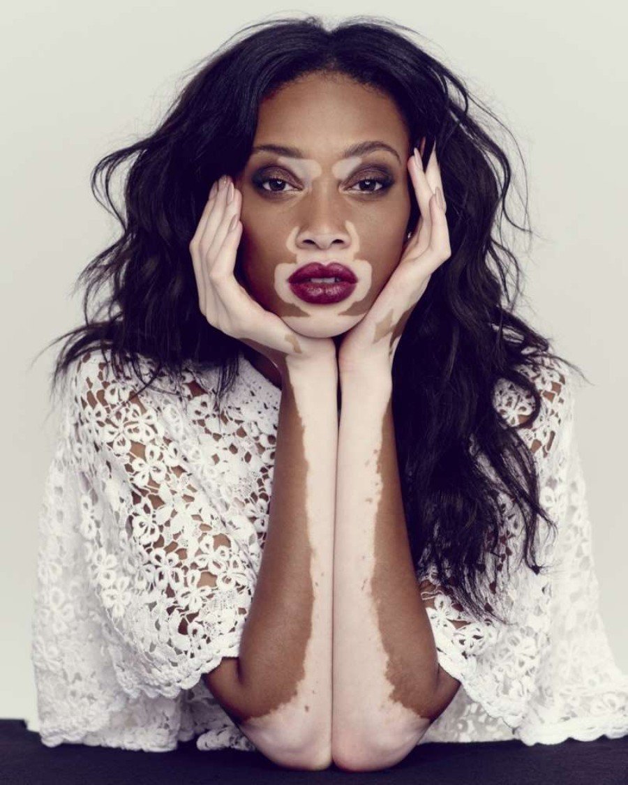 winnie harlow